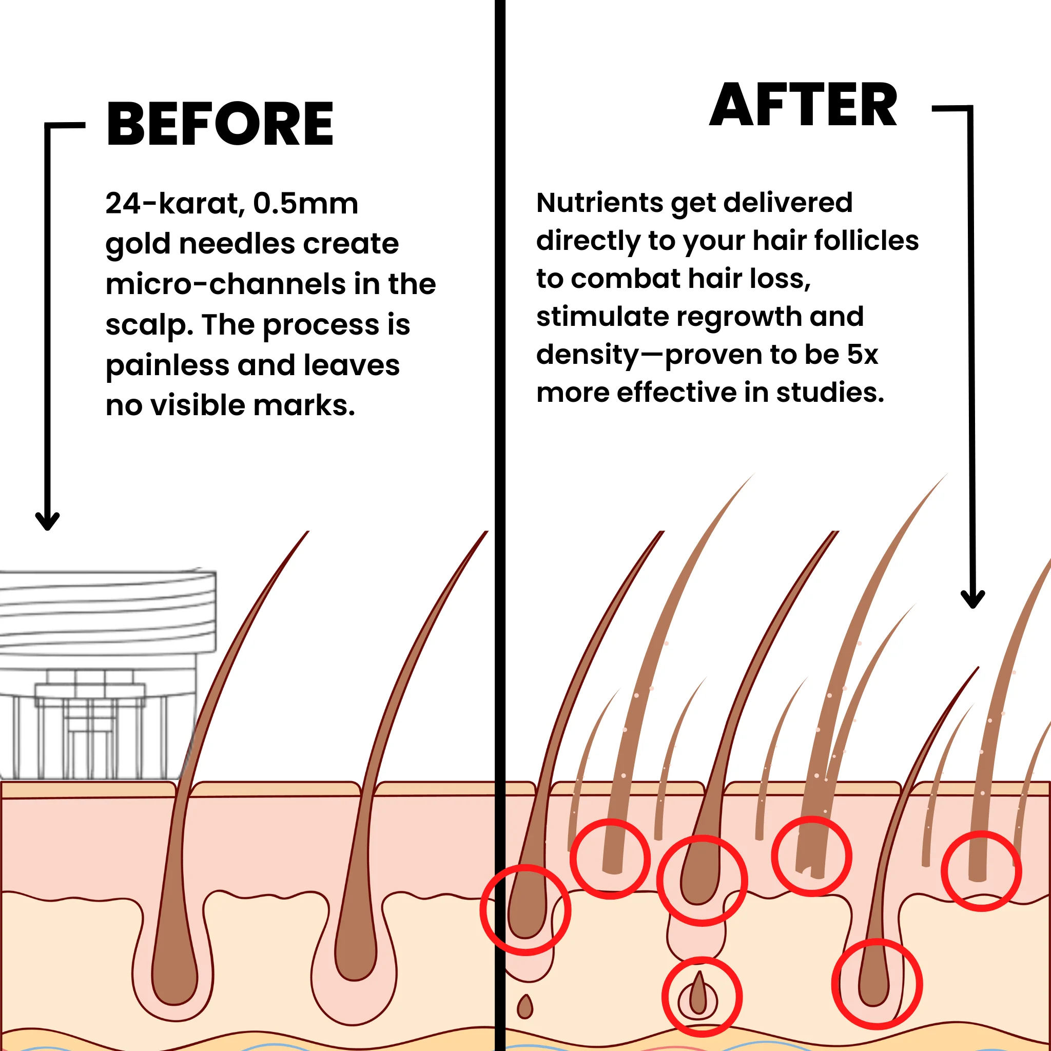 AlphaInfuseâ„¢ Hair Regrowth System - Image 2